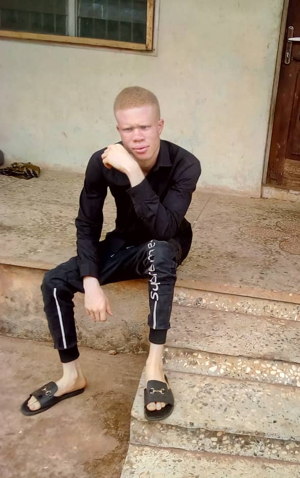 Albino Guy Sits on Steps